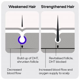 Minoxidil 5% Cutaneous Solution - 60ml